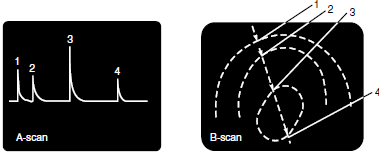 Ultrasound Scanning Techniques As Applied In Medical Imaging